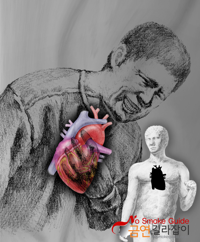 심장질환 이미지